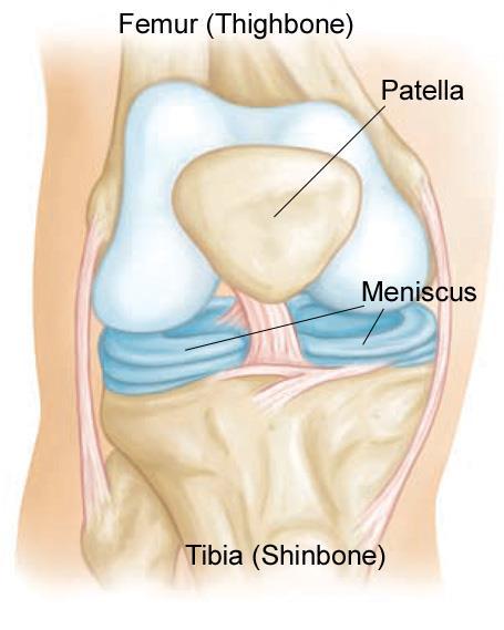 meniscus injury