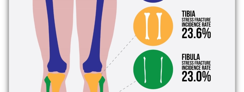 Stress Fracture of the Hip