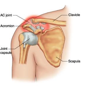 acromioclavicular joint