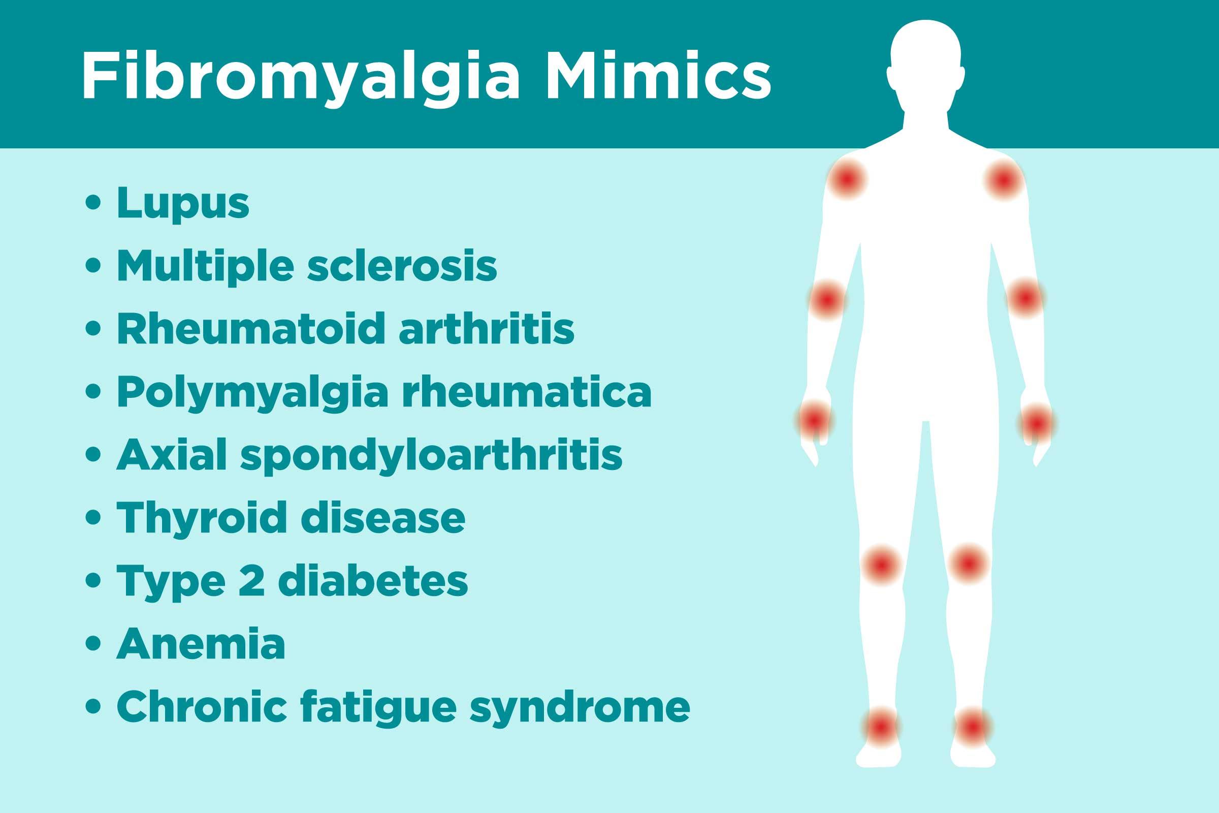 fibromyalgia