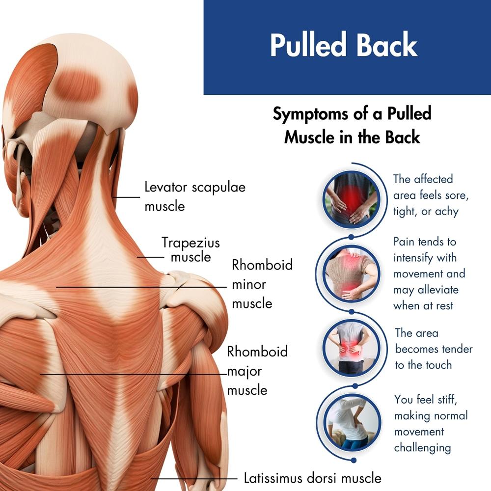 Back muscle strain