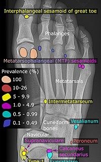 Sesamoid