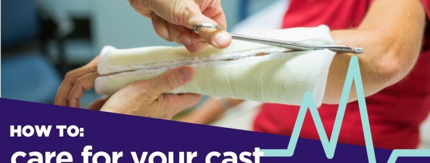 Cast Care