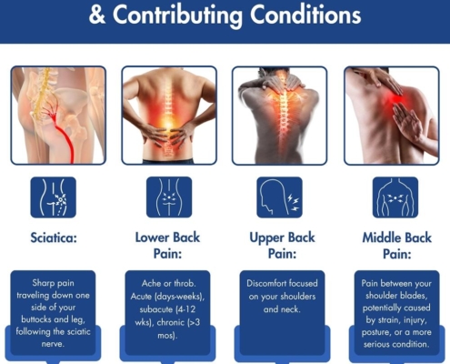 7 Common Missteps in Managing Back Pain You Should Avoid