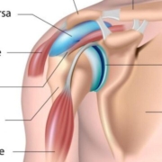 Bursitis: Understanding and Managing Inflamed Bursae