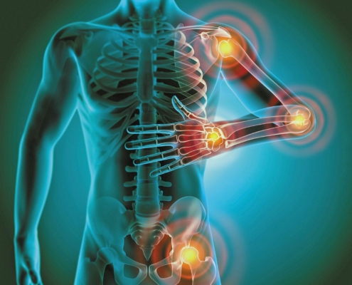 7 Effective Strategies to Combat Inflammation and Joint Pain