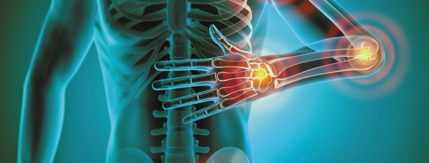 7 Effective Strategies to Combat Inflammation and Joint Pain