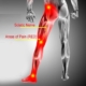 5 Effective Tips to Ease Your Sciatica Pain Naturally