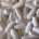 Osteoporosis: The Silent Thief of Bone Health